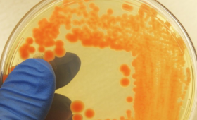 Microbe colonies growing in a Petri dish.