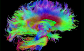 Brain image from magnetic resonance imaging (MRI) data