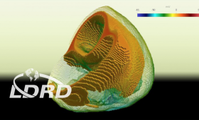 A still from a Cardioid simulation