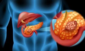 Artist's conception of pancreas.