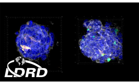 Two bluespherical blobs representing tumor and immune cells
